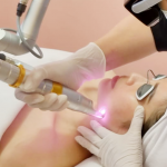 Process of hyperpigmentation treatment.