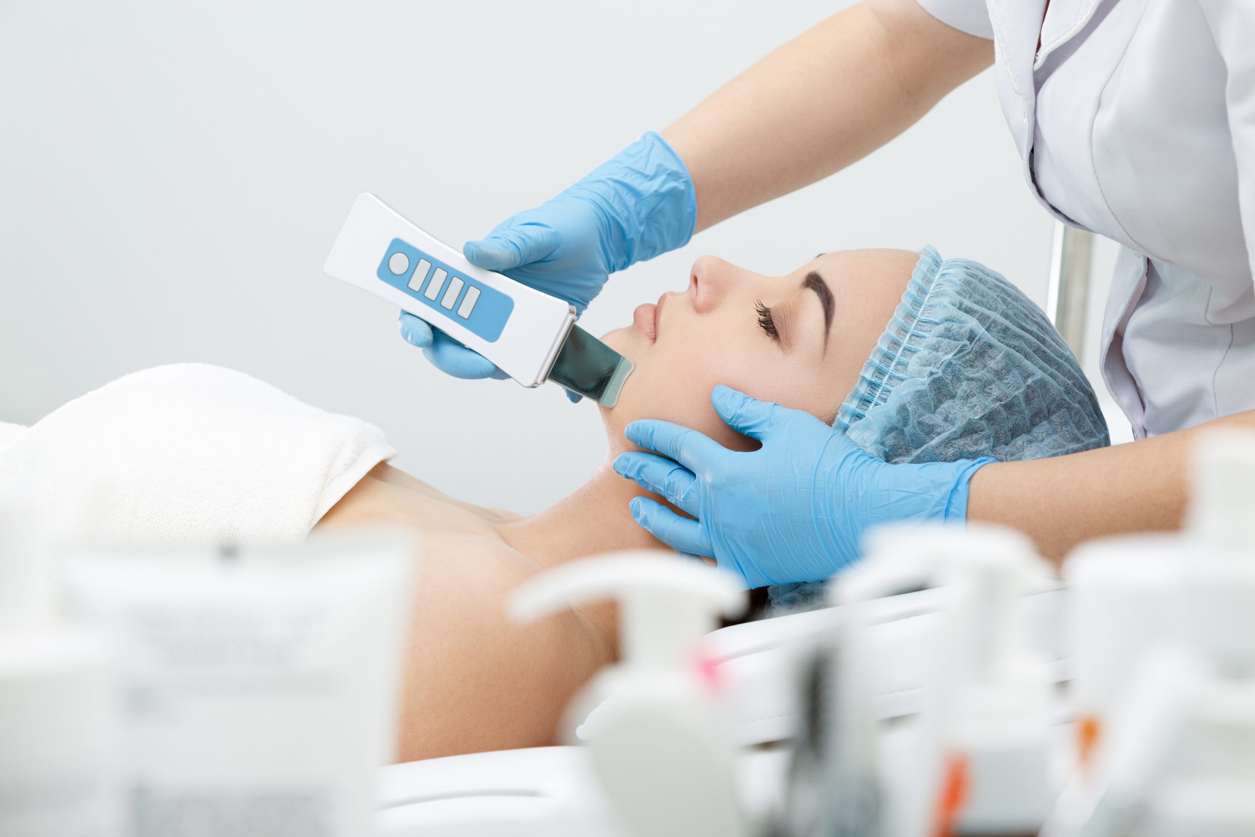 Woman undergoing laser treatment for acne scars.