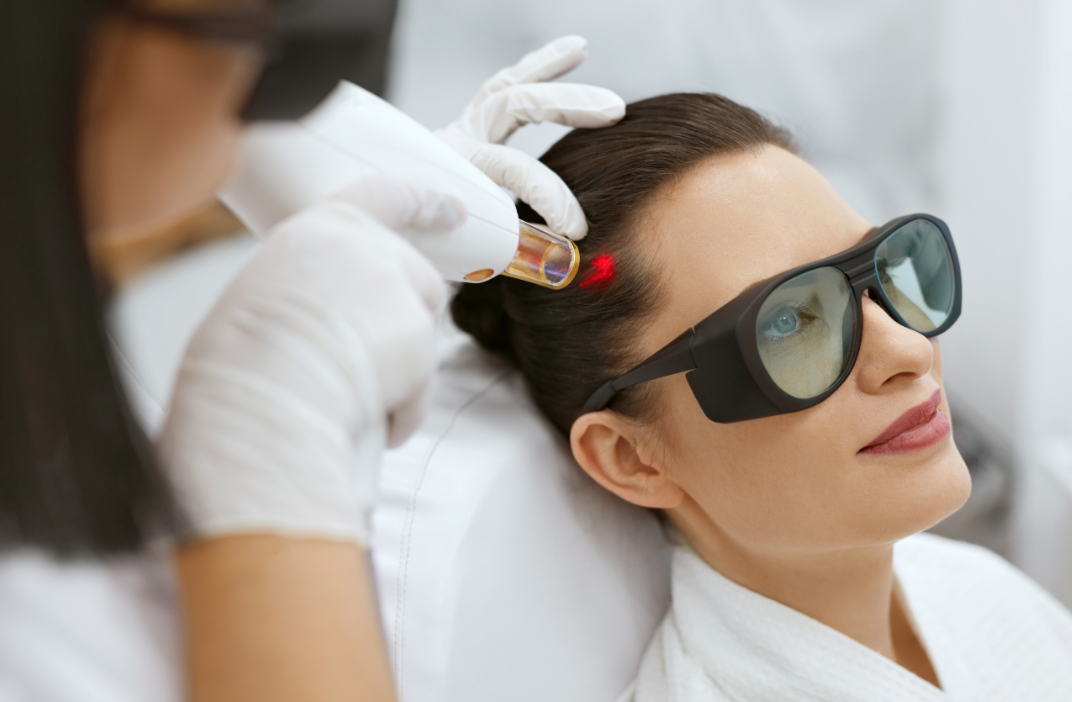 Woman undergoing scalp treatment for hair loss.