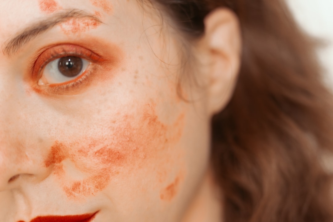 Photo pigmentation removal